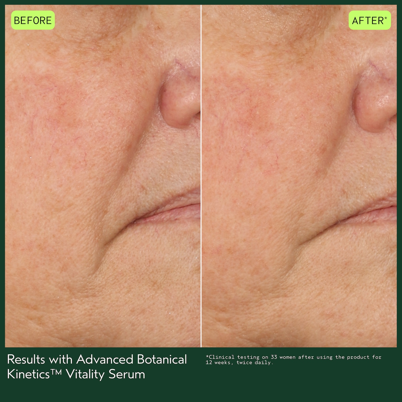 Advanced Botanical Kinetics™ Vitality Serum, 1 fl oz/30 ml